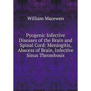   Abscess of Brain, Infective Sinus Thrombosis William Macewen Books