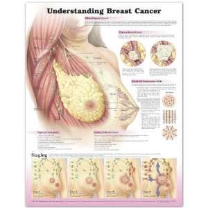  Female Breast Cancer Chart Industrial & Scientific