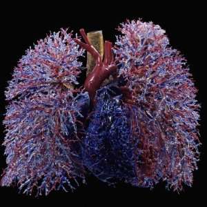  Resin Cast of Lungs, Heart, Blood Vessels, and Air 