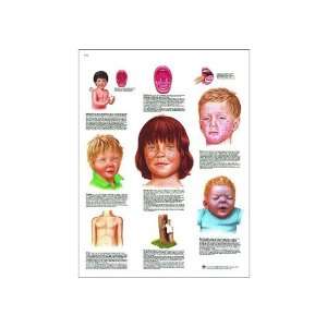 UV Resistant Laminated Paper Les Maladies Infantiles Anatomical Chart 
