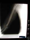 ARM ELBOW X RAY SKELETON HALLOWEEN LIGHT SCARE ART #66